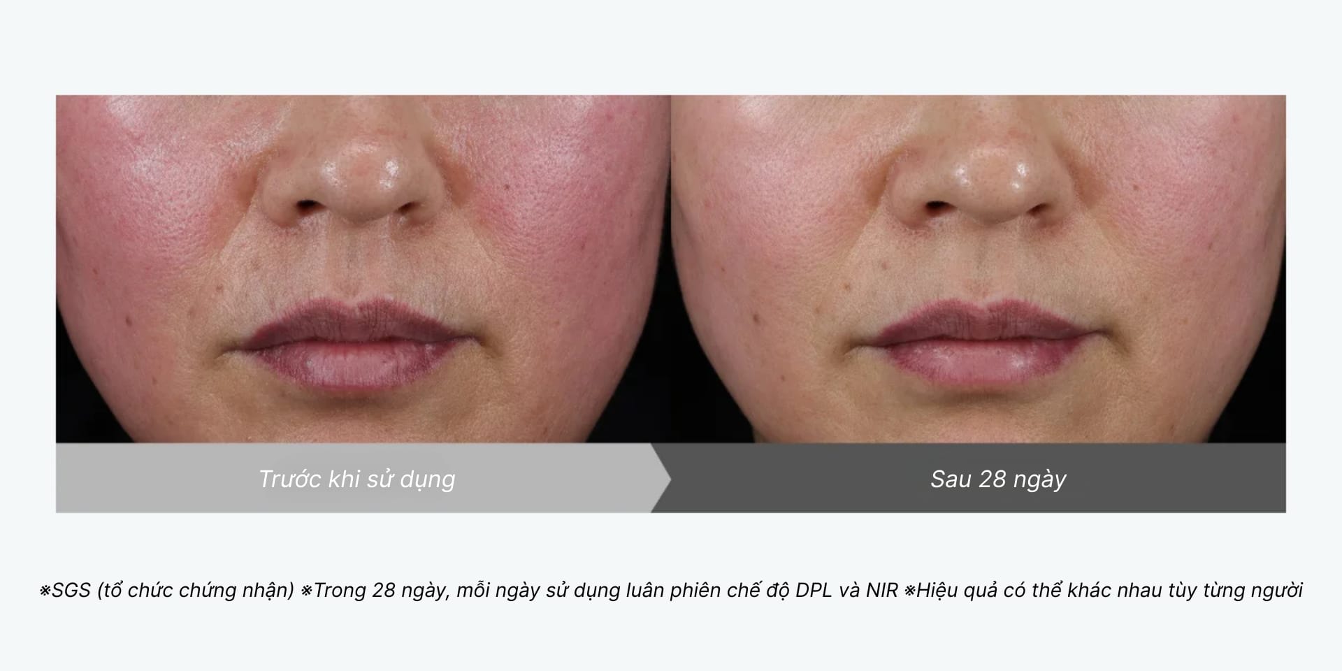 Trước khi sử dụng và sau 28 ngày sử dụng  
